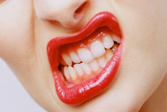 Diş Çekiminden Sonra İltihap Belirtileri ve Tedavisi