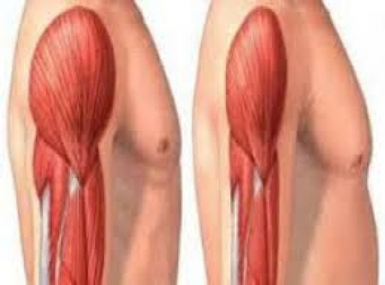 Kas İltihabı Belirtileri ve Tedavisi