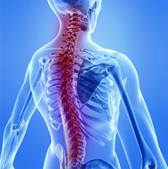 Omurilik İltihabı Belirtileri ve Tedavisi